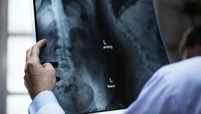 X-ray 영상을 살펴보는 모습